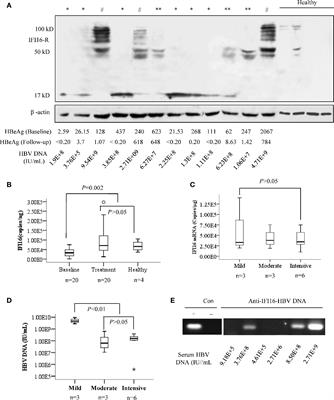 Interferon Gamma-Inducible Protein 16 of Peripheral Blood Mononuclear Cells May Sense Hepatitis B Virus Infection and Regulate the Antiviral Immunity